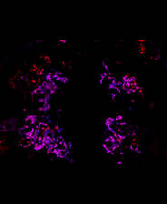 《片段》简体中文免安装版